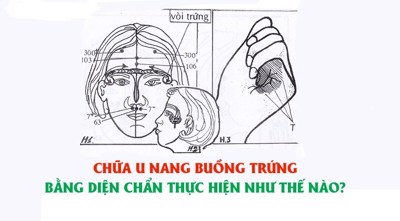 Chữa u nang buồng trứng bằng diện chẩn thực hiện như thế nào?